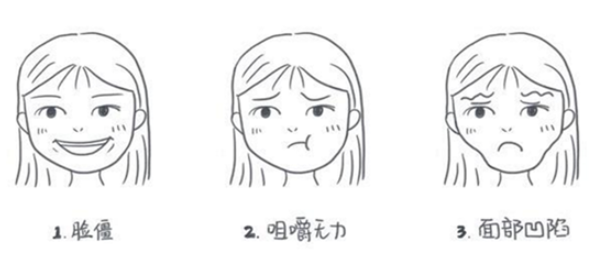 瘦臉針副作用多久出現 瘦臉針的過程