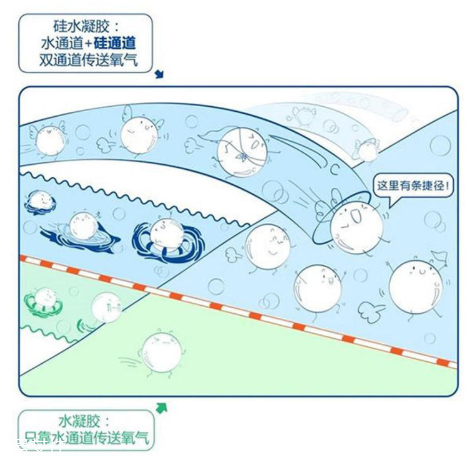 美瞳材質哪種好 挑選不可盲目跟風