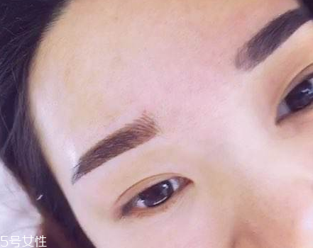 紋眉去醫院還是美容院 推薦是醫院