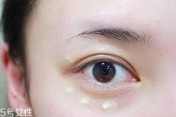 去黑眼圈用什么眼霜好 不同類型區別對待