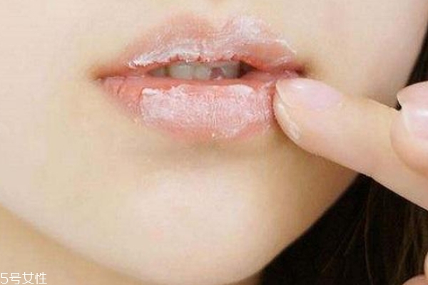 唇部去角質的自制方法 這個妙招省錢又有效