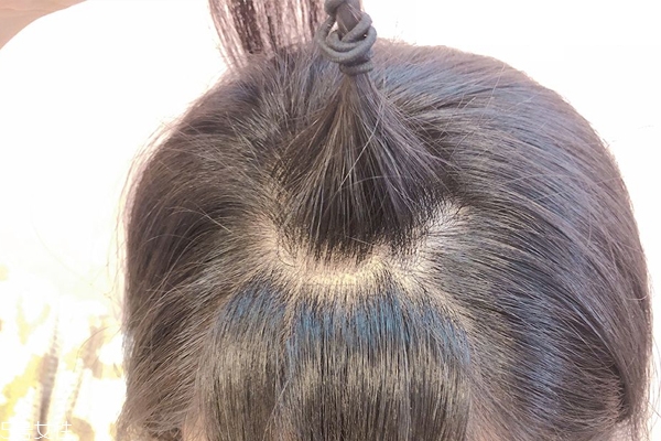 發量少怎么扎馬尾圖解 2招拯救微禿女孩