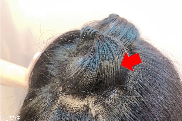 發量少怎么扎馬尾圖解 2招拯救微禿女孩