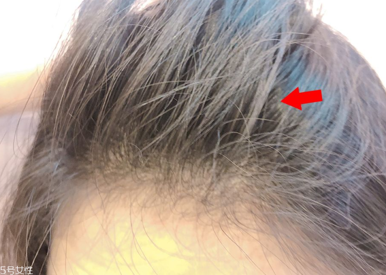 發量少怎么扎馬尾圖解 2招拯救微禿女孩