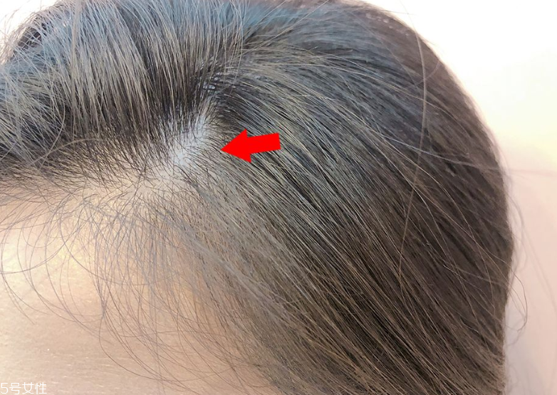 發量少怎么扎馬尾圖解 2招拯救微禿女孩