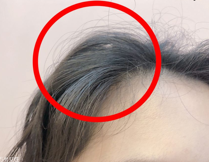 發量少怎么扎馬尾圖解 2招拯救微禿女孩