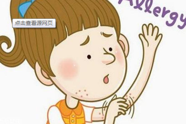 神經性皮炎是什么 怎么護理
