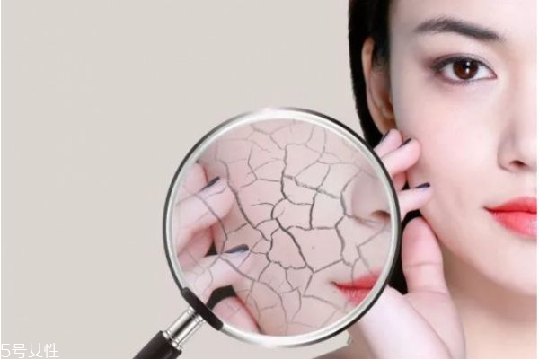 女人25歲后怎么保養皮膚 皮膚衰老的三個階段