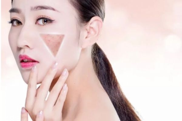 女人25歲后怎么保養皮膚 皮膚衰老的三個階段