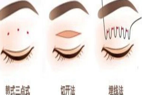 韓式三點和埋線的區別 你適合做什么樣的