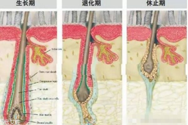 哪些人不適合植發 這些人群不適合植發