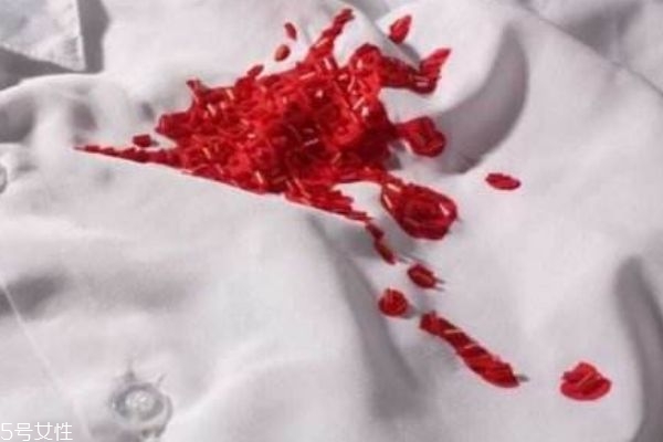 衣服上的血跡怎么洗掉 洗已經干了的血跡怎么洗掉