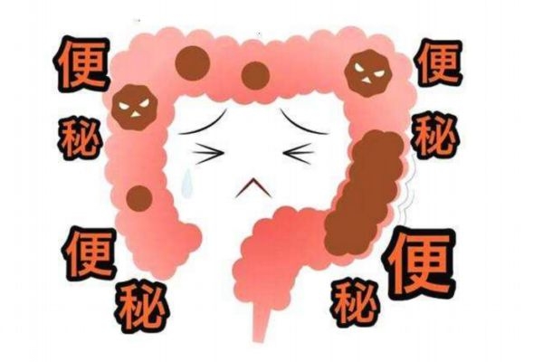 便秘的治療方法有哪些 坐班族輕敲膽經防便秘