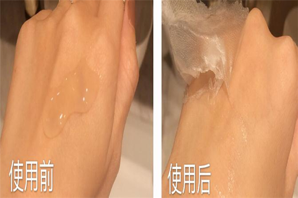 乾佰納生物膜多少錢 醫用生物修復膜