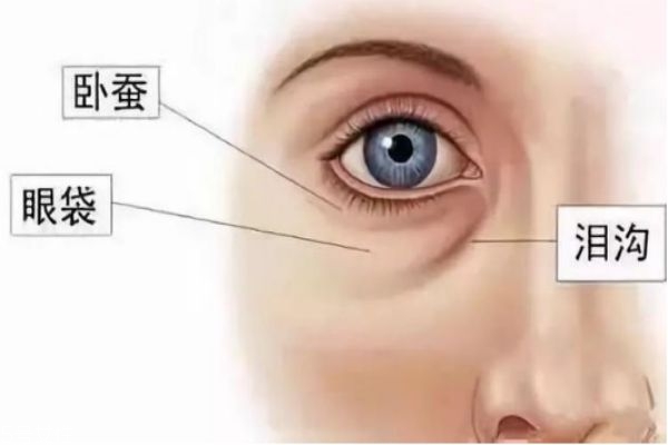 眼袋內切好還是外切好 去眼袋內切和外切區別