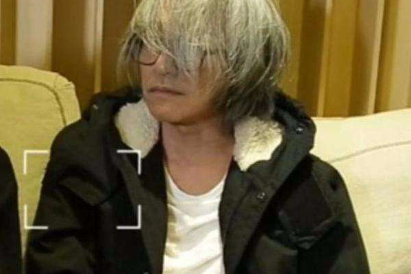 白頭發可以染色嗎 白頭發的治療