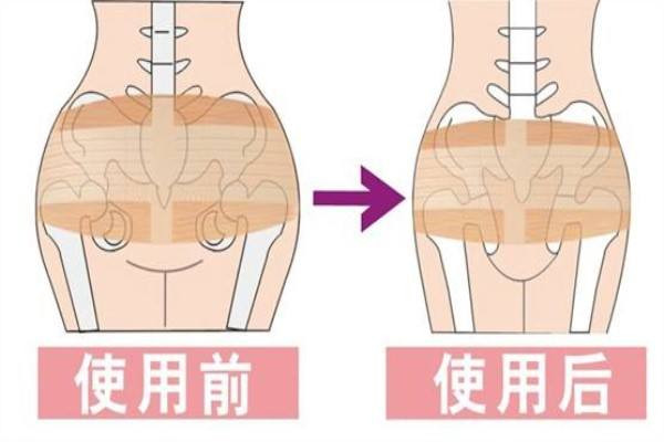 產后胯骨變寬怎么恢復 產后簡單瘦身方法有哪些