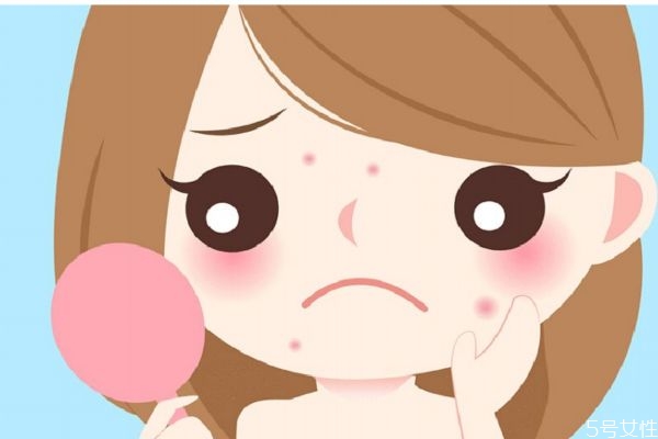 如果消除痘印呢 痘印可以自己恢復嗎