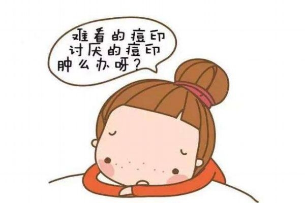 痘印發紅是為什么呢 造成痘印發紅的原因是什么呢