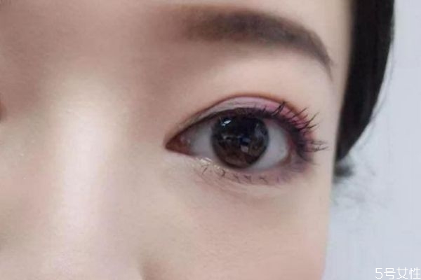 淚溝紋可以預防嗎 淚溝紋和眼袋的區別是什么呢