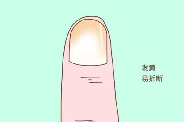如何增長甲床 如何把甲床養得好看