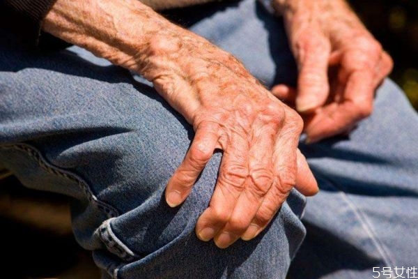 帕金森的高發人群有哪些呢 如何預防帕金森呢