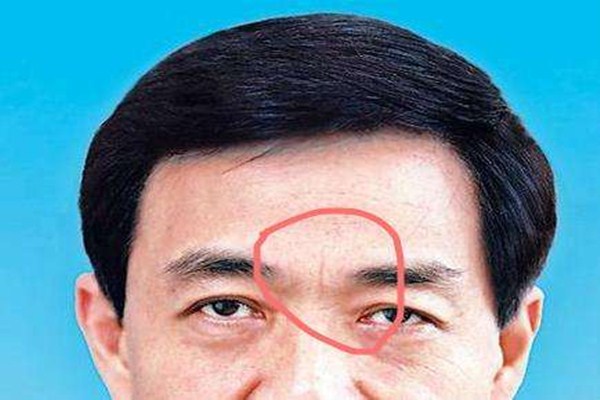 什么是懸針紋 如何預防懸針紋出現
