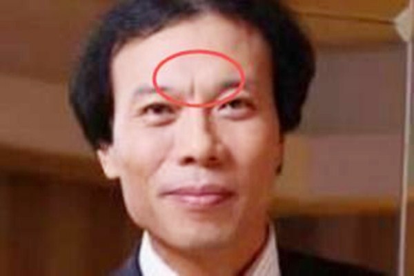 什么是懸針紋 如何預防懸針紋出現