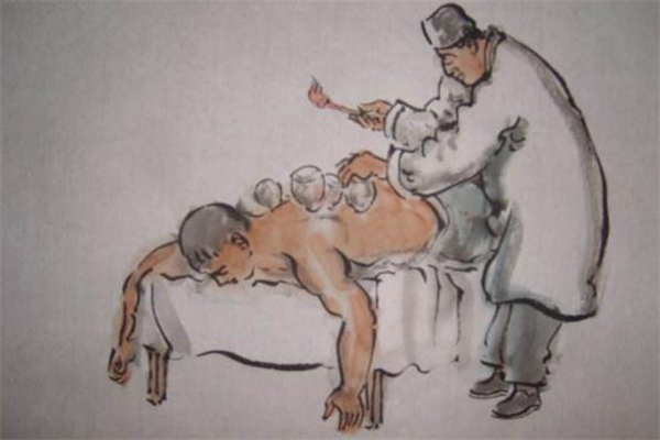 拔罐減肥什么時間最好 拔罐減肥什么季節最好