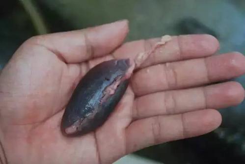 魚膽有毒嗎 魚膽中毒的表現