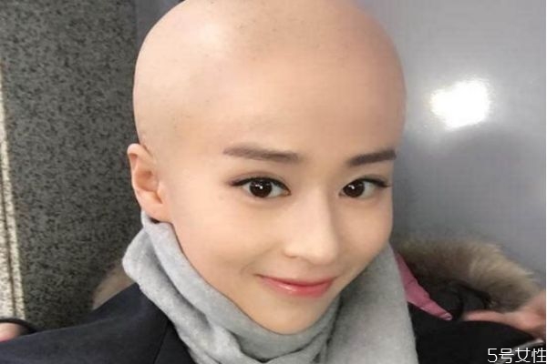 剃光頭之后頭發會變多嗎 頭發剃光再長會變多嗎