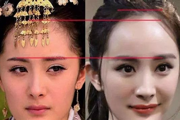 發際線可以自行恢復嗎 發際線后移的原因