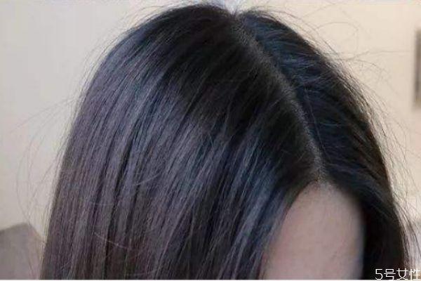 劉海三角區禿了怎么辦 頭頂劉海處禿了怎么補救