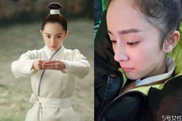 發際線后移如何預防 如何防止發際線繼續后移