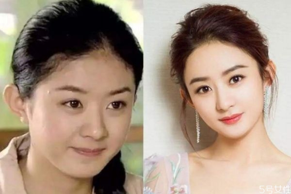 額頭發際線高怎么辦 這么做告別大額頭