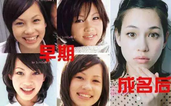 日式整容和韓式整容有什么區別 極致美與自然美
