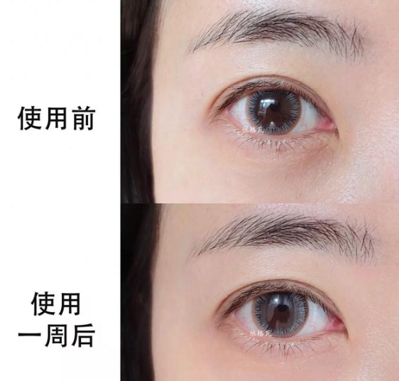 護膚與不護膚的區別圖 護膚與不護膚的對比差距大嗎