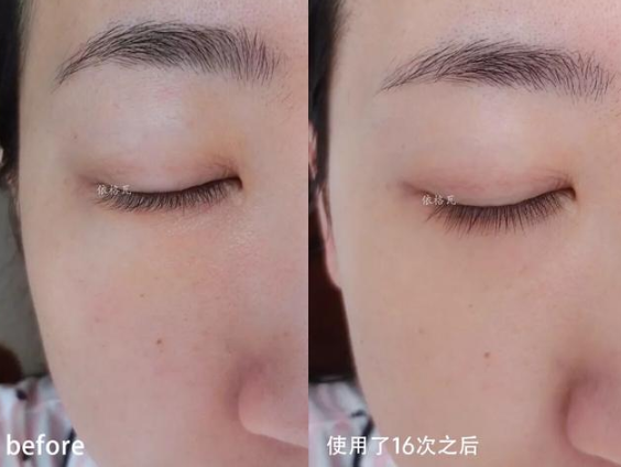 護膚與不護膚的區別圖 護膚與不護膚的對比差距大嗎