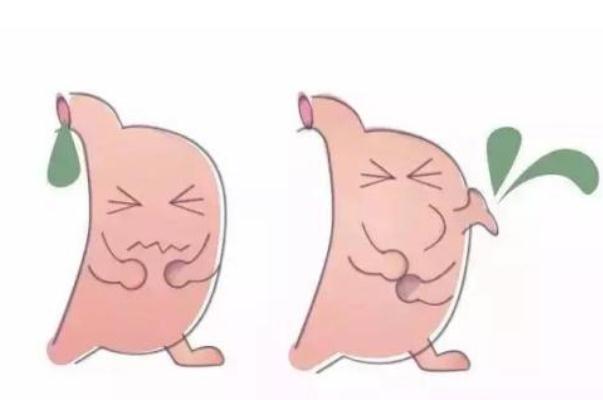 胃潰瘍的好發部位是 胃潰瘍的并發癥