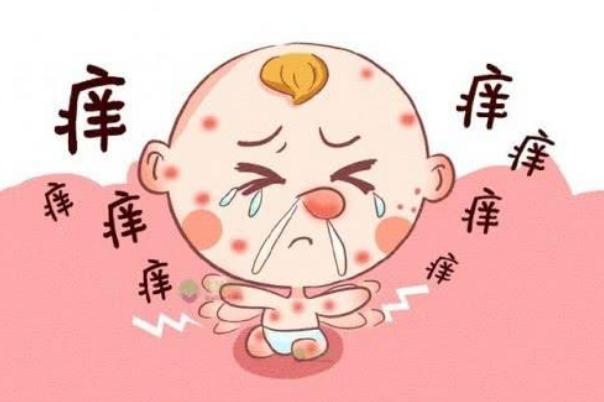 孩子過敏要去醫院嗎 孩子過敏要吃什么藥