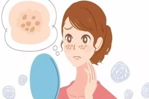 妊娠斑是怎么形成的 妊娠斑怎么調理可以淡斑