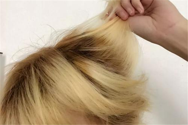 漂發后頭皮結痂用什么藥 漂發后頭皮結痂會禿嗎