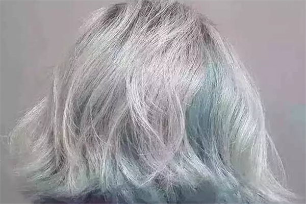 染頭發后有大塊頭皮屑怎么辦 染頭發后頭皮屑多是什么原因