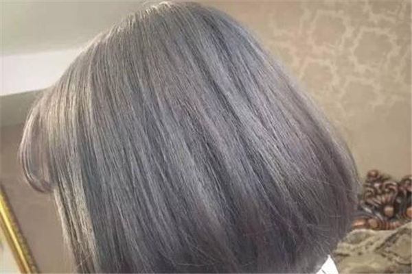 染頭發后有大塊頭皮屑怎么辦 染頭發后頭皮屑多是什么原因