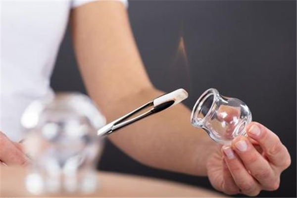 拔罐用火罐好還是氣罐好 拔火罐和氣罐的區別