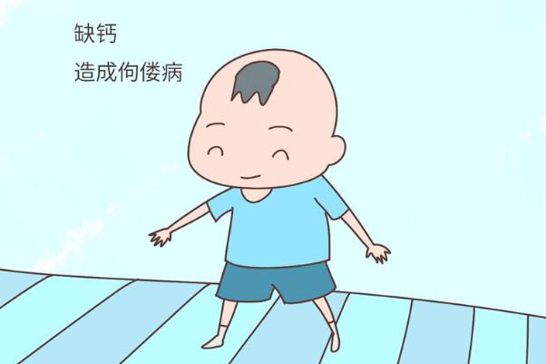 佝僂病有哪些癥狀和表現 佝僂病缺少什么元素