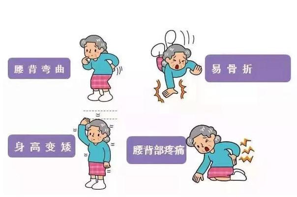 骨質疏松有哪些癥狀表現 骨質疏松怎么治才能徹底治好