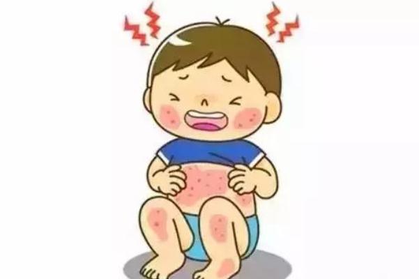 寶寶長痱子的原因是什么 寶寶長痱子的地方發熱怎么辦