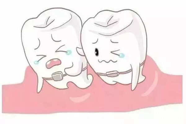 牙齒矯正會導致牙齒敏感嗎 牙齒矯正會導致牙齒隱裂嗎