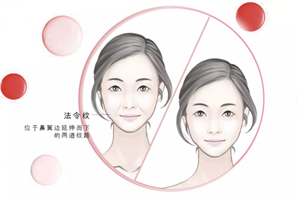 法令紋會遺傳嗎 法令紋跟什么有關系